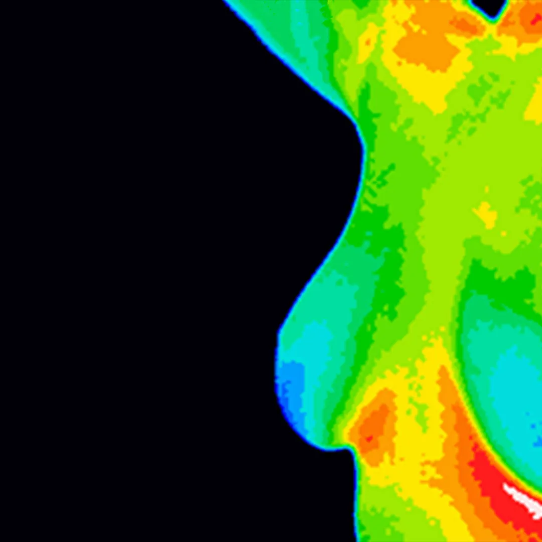 breast cancer thermography